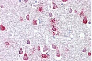 Immunohistochemistry with Brain, cortex tissue at an antibody concentration of 5µg/ml using anti-PPME1 antibody (ARP56845_P050) (PPME1 抗体  (N-Term))