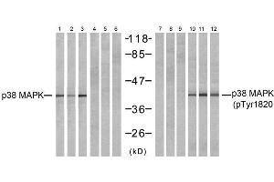 Western blot analysis of extracts from NIH-3T3 (Line 1, 4, 7 and 10) and COS7 (Line 2, 5, 8 and 11 and K562 (Line 3, 6, 9 and 12) cells, untreated or treated with (MAPK14 抗体)