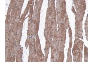 Immunohistochemistry (IHC) image for anti-Myoglobin (MB) (AA 1-154) antibody (ABIN7429604)