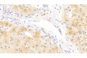 Detection of SAA2 in Human Liver Tissue using Polyclonal Antibody to Serum Amyloid A2 (SAA2) (SAA2 抗体  (AA 19-122))