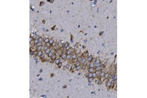 IHC analysis of KCNQ5 using anti-KCNQ5 antibody (ABIN7602178).