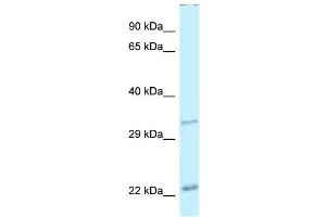 WB Suggested Anti-Pdx1 Antibody Titration: 1. (PDX1 抗体  (N-Term))