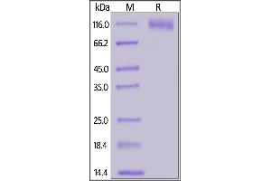 SARS-CoV-2 S1 protein (D614G), His Tag on SDS-PAGE under reducing (R) condition. (SARS-CoV-2 Spike S1 Protein (D614G) (His tag))
