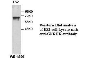 Image no. 1 for anti-Gonadotropin-Releasing Hormone Receptor (GNRHR) antibody (ABIN791149) (GNRHR 抗体)