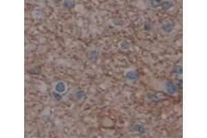 Immunohistochemistry (IHC) image for anti-Glutamate Receptor, Ionotropic, AMPA 2 (GRIA2) (AA 25-543) antibody (ABIN1868258)