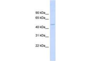 Image no. 1 for anti-Drebrin-Like (DBNL) (AA 251-300) antibody (ABIN6743772) (DBNL 抗体  (AA 251-300))