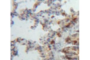 Used in DAB staining on fromalin fixed paraffin-embedded Lung tissue (ADAMTS8 抗体  (AA 832-889))