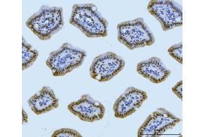 IHC analysis of MRE11 using anti-MRE11 antibody (ABIN7600025).