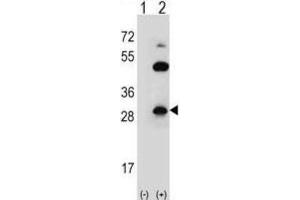 Western Blotting (WB) image for anti-Claudin 2 (CLDN2) antibody (ABIN2996861) (Claudin 2 抗体)