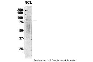 Sample Type: 1. (Nucleolin 抗体  (C-Term))