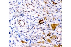 IHC analysis of Plectin using anti-Plectin antibody (ABIN3043900).