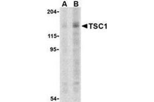 Western blot analysis of TSC1 in C2C12 cell lysate with this product at (A) 2 and (B) 4 μg. (TSC1 抗体  (C-Term))