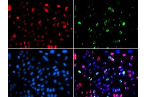 Immunofluorescence (IF) image for anti-Tumor Protein P53 (TP53) (pSer15) antibody (ABIN3023601) (p53 抗体  (pSer15))