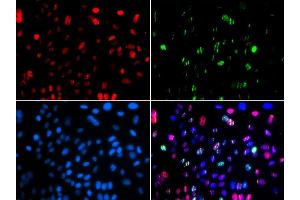 Immunofluorescence (IF) image for anti-Tumor Protein P53 (TP53) (pSer15) antibody (ABIN3023601) (p53 抗体  (pSer15))