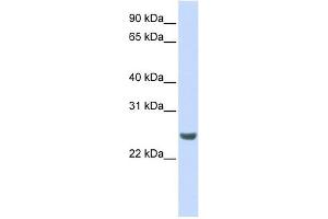 NKIRAS1 antibody used at 1 ug/ml to detect target protein. (NKIRAS1 抗体  (N-Term))