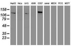 Image no. 8 for anti-Glutamyl Aminopeptidase (Aminopeptidase A) (ENPEP) antibody (ABIN1498029)