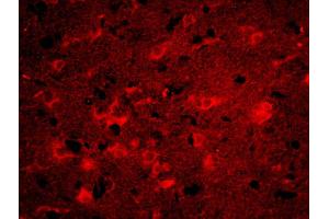 Formalin-fixed and paraffin-embedded rat brain labeled with Anti-ITM2A Polyclonal Antibody, Unconjugatedused at 1:200 dilution for 40 minutes at 37°C. (ITM2A 抗体  (AA 73-123))