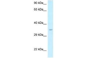Western Blot showing Six1 antibody used at a concentration of 1. (SIX Homeobox 1 抗体  (N-Term))