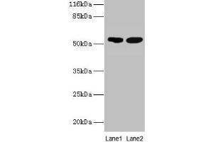 Western blot All lanes: SVOPL antibody at 2 μg/mL Lane 1: Mouse liver tissue Lane 2: Rat liver tissue Secondary Goat polyclonal to rabbit IgG at 1/10000 dilution Predicted band size: 54, 37 kDa Observed band size: 54 kDa (SVOPL 抗体  (AA 73-129))