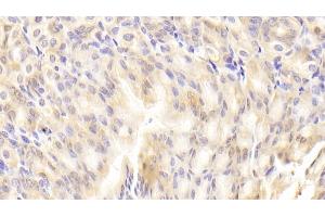 Immunohistochemistry (IHC) image for anti-Retinol Binding Protein 2, Cellular (RBP2) (AA 1-134) antibody (ABIN7429292)