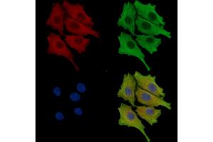 ABIN7095746 and ABIN7099808 staining HepG2 cells by IF/ICC. (TFB1M 抗体)