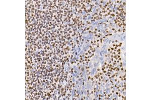 Immunohistochemistry of paraffin-embedded human tonsil using IKZF3 antibody (ABIN7267842) at dilution of 1:100 (40x lens). (IKZF3 抗体)