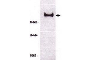 Western blot analysis of TP53BP1 in untreated U-2 OS cell lysate with TP53BP1 polyclonal antibody . (TP53BP1 抗体)