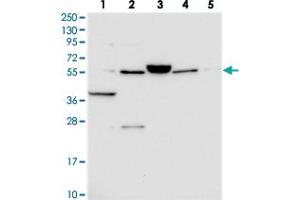 Western blot analysis of Lane 1: RT-4, Lane 2: U-251 MG, Lane 3: Human Plasma, Lane 4: Liver, Lane 5: Tonsil with C10orf129 polyclonal antibody . (C10ORF129 抗体)