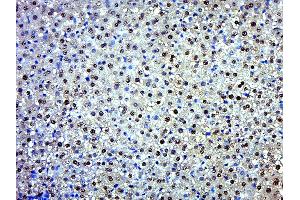 Paraformaldehyde-fixed, paraffin embedded Rat liver Antigen retrieval by boiling in sodium citrate buffer (pH6. (EXD2 抗体  (AA 351-621))