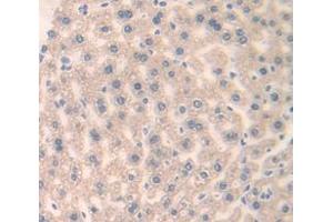 IHC-P analysis of Human Tissue, with DAB staining. (FRS2 抗体  (AA 239-449))