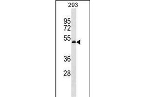 RCBTB1 Antibody (Center) (ABIN1538342 and ABIN2848507) western blot analysis in 293 cell line lysates (35 μg/lane). (RCBTB1 抗体  (AA 350-377))
