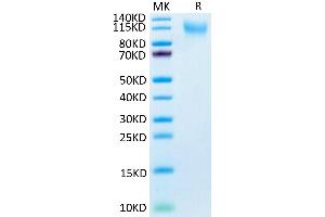 CD34 Protein (CD34) (AA 32-290) (His tag)