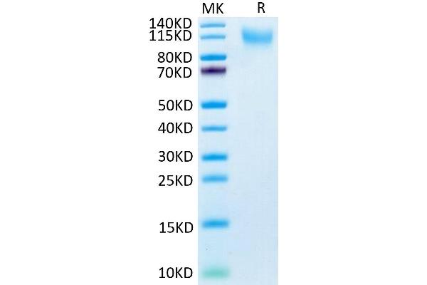 CD34 Protein (CD34) (AA 32-290) (His tag)