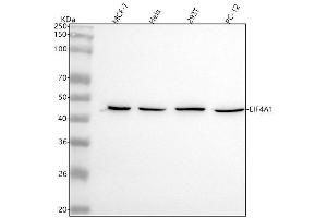 Western blot analysis of EIF4A1 using anti-EIF4A1 antibody (ABIN7604735).