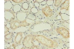 Immunohistochemistry of paraffin-embedded human kidney tissue using ABIN7174641 at dilution of 1:100 (UGT2B4 抗体  (AA 281-481))