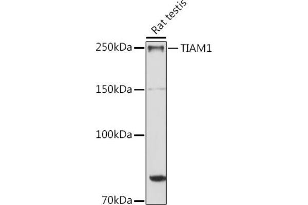 TIAM1 抗体  (AA 1392-1591)