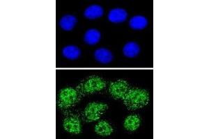 Confocal immunofluorescent analysis of MSH2 antibody with HeLa cells followed by Alexa Fluor 488-conjugated goat anti-rabbit lgG (green).