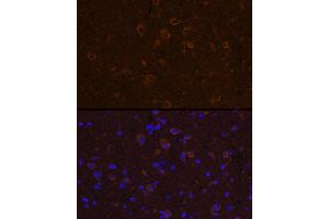 Immunofluorescence analysis of mouse spinal cord using CNTF Rabbit pAb (ABIN3015704, ABIN3015705, ABIN3015706 and ABIN6219054) at dilution of 1:100 (40x lens). (CNTF 抗体  (AA 1-200))