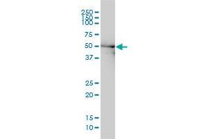 DDX6 monoclonal antibody (M01), clone 3D2 Western Blot analysis of DDX6 expression in Hela . (DDX6 抗体  (AA 1-483))