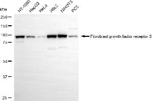 Western blotting analysis using fibroblast growth factor receptor 3 antibody (ABIN7798610). (Recombinant FGFR3 抗体)