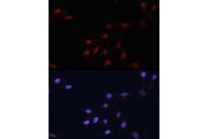 Immunofluorescence analysis of NIH/3T3 cells using p53 antibody (ABIN3017540, ABIN3017541, ABIN3017542 and ABIN6220145) at dilution of 1:100. (p53 抗体)