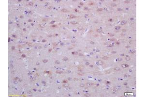 Formalin-fixed and paraffin embedded rat brain labeled with Rabbit Anti ACTH (18-39) Polyclonal Antibody, Unconjugated (ABIN668661) at 1:200 followed by conjugation to the secondary antibody and DAB staining (ACTH 抗体  (AA 18-39))