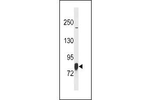 LIMK1 Antibody (T9) (ABIN392258 and ABIN2841942) western blot analysis in SK-BR-3 cell line lysates (35 μg/lane). (LIM Domain Kinase 1 抗体  (N-Term))