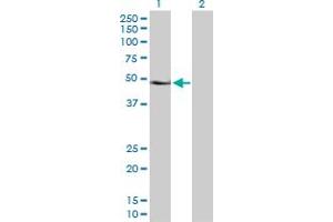 Western Blot analysis of PAX6 expression in transfected 293T cell line by PAX6 MaxPab polyclonal antibody. (PAX6 抗体  (AA 1-422))