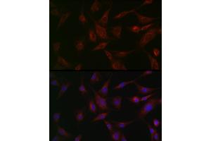 Immunofluorescence analysis of BALB-3T3 cells using NSF Rabbit pAb (ABIN6130571, ABIN6144871, ABIN6144872 and ABIN6214029) at dilution of 1:100 (40x lens).