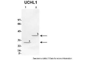 Sample Type: 1. (UCHL1 抗体  (C-Term))