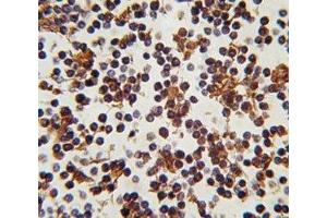 Immunohistochemistry (IHC) image for anti-Forkhead Box P3 (FOXP3) (AA 283-311) antibody (ABIN3030998)