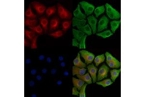 Phospho-Hexokinase 1 (Tyr732) Antibody staining Hela cells(heat shock treatment) by IF/ICC. (Hexokinase 1 抗体  (pTyr732))