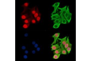 ABIN7095146 and ABIN7099202 staining Hela cells by IF/ICC.