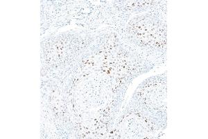 Immunohistochemistry (IHC) image for anti-Cyclin-Dependent Kinase Inhibitor 1A (p21, Cip1) (CDKN1A) (AA 100-150) antibody (ABIN7795765) (Recombinant p21 抗体  (AA 100-150))
